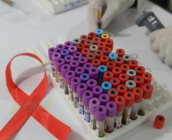 Thử nghiệm vaccine phòng ngừa HIV/AIDS trên người sau 8 năm nghiên cứu