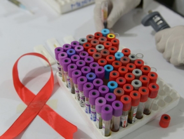 Thử nghiệm vaccine phòng ngừa HIV/AIDS trên người sau 8 năm nghiên cứu